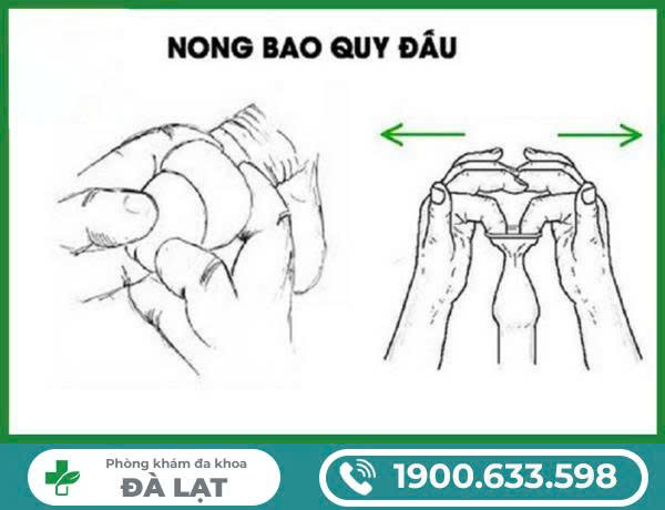 Hình ảnh minh họa